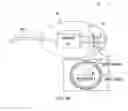 Fig. 23 - Receiver assembly for an inflatable ear device