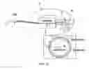 Fig. 24 - Receiver assembly for an inflatable ear device