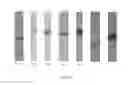 Fig. 06 - Antibodies and methods for treating estrogen receptor-associated diseases