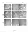 Fig. 06 - Methods of treatment of bone degenerative diseases