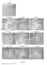 Fig. 08 - Methods of treatment of bone degenerative diseases