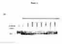 Fig. 04 - NOTCH1 receptor antibodies and methods of treatment