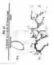 Fig. 33 - Methods and compositions relating to CCR5 antagonist, IFN-γ and IL-13 induced inflammation