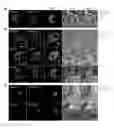 Fig. 04 - Methods and compositions for treating and preventing malaria using an invasion ligand directed to a protease-resistant receptor