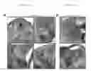 Fig. 08 - Methods and compositions for treating and preventing malaria using an invasion ligand directed to a protease-resistant receptor