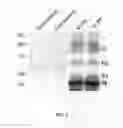 Fig. 04 - Fusogenic virus-like particles and uses thereof