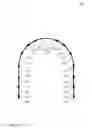 Fig. 02 - ORTHODONTIC DEVICE
