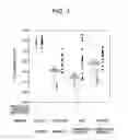 Fig. 04 - METHOD OF DETERMINING LYMPH NODE METASTASIS IN A LUNG CANCER, APPARATUS FOR DETERMINING LYMPH NODE METASTASIS IN A LUNG CANCER, AND COMPUTER PROGRAM PRODUCT