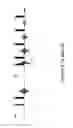 Fig. 08 - NMR detection of coagulation time