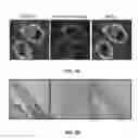 Fig. 14 - Plasma membrane isolation