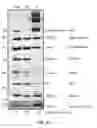 Fig. 15 - Plasma membrane isolation