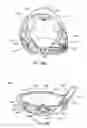 Fig. 30 - Golf club head