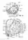 Fig. 45 - Golf club head
