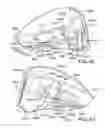 Fig. 46 - Golf club head