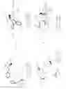 Fig. 93 - MICROFLUIDIC DEVICE WITH APERTURE WITH GEOMETRY TO PROMOTE UNPINNED FLOW-THROUGH OF FLUID