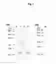 Fig. 02 - Process for producing a green fluorescent protein comprising coelenteramide or an analog thereof