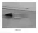 Fig. 48 - Adjustable connector, improved fluid flow and reduced clotting risk