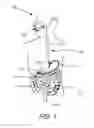 Fig. 02 - Device for electrically and mechanically stimulating a compartment in a body