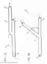 Fig. 03 - Devices, systems, and methods for organ retroperfusion