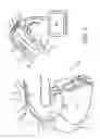Fig. 04 - Devices, systems, and methods for organ retroperfusion