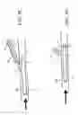 Fig. 10 - Devices, systems, and methods for organ retroperfusion