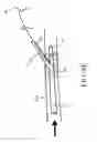 Fig. 11 - Devices, systems, and methods for organ retroperfusion