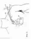 Fig. 12 - Devices, systems, and methods for organ retroperfusion