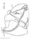 Fig. 13 - Devices, systems, and methods for organ retroperfusion