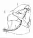 Fig. 14 - Devices, systems, and methods for organ retroperfusion