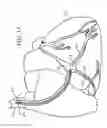 Fig. 16 - Devices, systems, and methods for organ retroperfusion