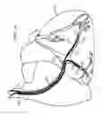 Fig. 17 - Devices, systems, and methods for organ retroperfusion