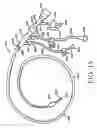 Fig. 18 - Devices, systems, and methods for organ retroperfusion