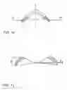 Fig. 09 - Method for treating refractive errors and vision disorders of an eye