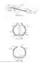 Fig. 02 - Dual modulus balloon for interventional procedures