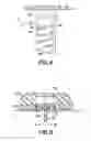Fig. 04 - Infusion set and/or patch pump having at least one of an in-dwelling rigid catheter with flexible features and/or a flexible catheter attachment