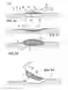 Fig. 02 - DEVICE FOR THE TREATMENT OF WOUNDS USING A VACUUM