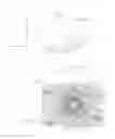 Fig. 02 - Vacuum therapy and cleansing dressing for wounds
