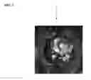 Fig. 06 - MECHANICAL BARRIER IN WOUND HEALING