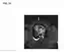 Fig. 09 - MECHANICAL BARRIER IN WOUND HEALING