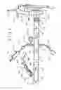 Fig. 02 - Fecal management appliance and method and apparatus for introducing same