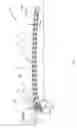 Fig. 02 - Implant for bone fixation