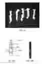 Fig. 09 - Method and apparatus for tissue grafting and copying