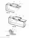 Fig. 04 - SUTURE BUCKLE WITH SELECTIVE FRICTION