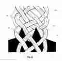 Fig. 09 - SUTURE BUCKLE WITH SELECTIVE FRICTION