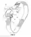 Fig. 10 - SUTURE BUCKLE WITH SELECTIVE FRICTION