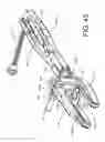 Fig. 43 - System for percutaneously fixing a connecting rod to a spine