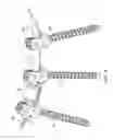 Fig. 06 - Flexible spinal stabilization element and system