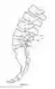 Fig. 02 - METHOD AND APPARATUS FOR SPINAL STABILIZATION