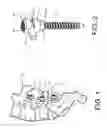 Fig. 02 - Pedicle screw extension for use in percutaneous spinal fixation