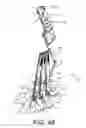 Fig. 49 - Pedicle screw extension for use in percutaneous spinal fixation